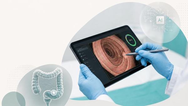 Immagine di un tablet che mostra un'analisi endoscopica digitale, evidenziando l'uso dell'intelligenza artificiale in sanità e la stadiazione precoce del cancro al colon retto.